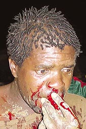 Univen bash turns into bloody brawl