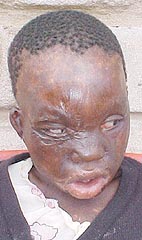Brave little heroin pleads for help
