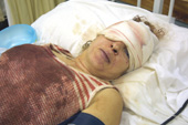 German farming couple survives brutal attack