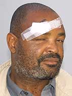 Former mayor hit over head with broomstick