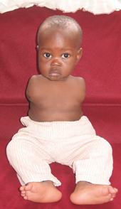 Family dreams of arms and hands for one-year-old