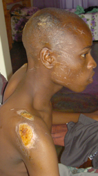 Std 10 learner seriously injured in accident