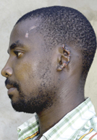 Man escapes from muti butchers