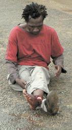 Man breaks leg after “falling” from moving truck