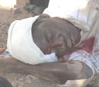 Mozambican hit by speeding taxi