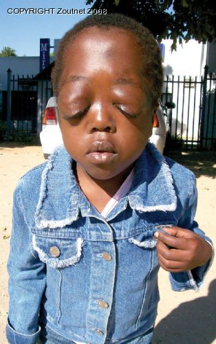 Young Mulamuleli needs help