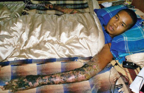“Help me before the disease kills me”