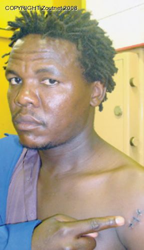 Well-known photographer survives brutal attack
