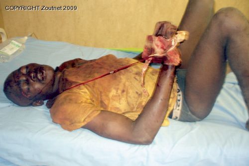Mozambican suspect in court following death of young girl