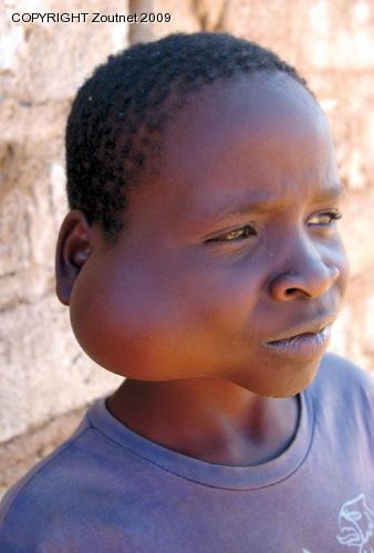 Boy with deformed face needs help