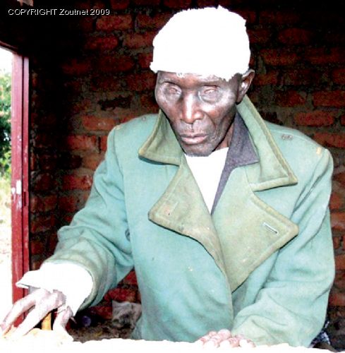 Blind pensioner attacked for R30