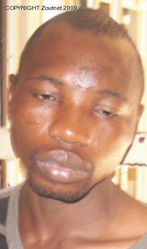 Alleged rapist loses part of his tongue