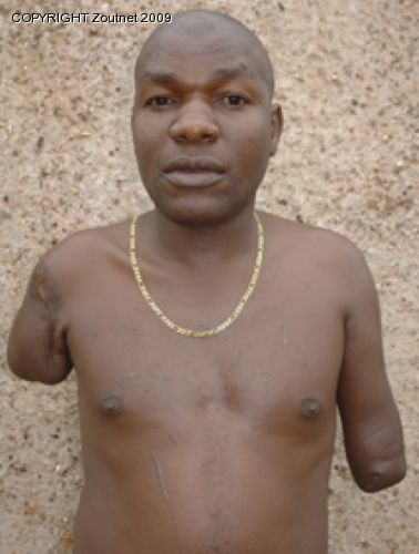 Road accident leaves taxi driver unemployed and desperate