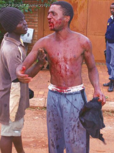 Man badly injured in street fight