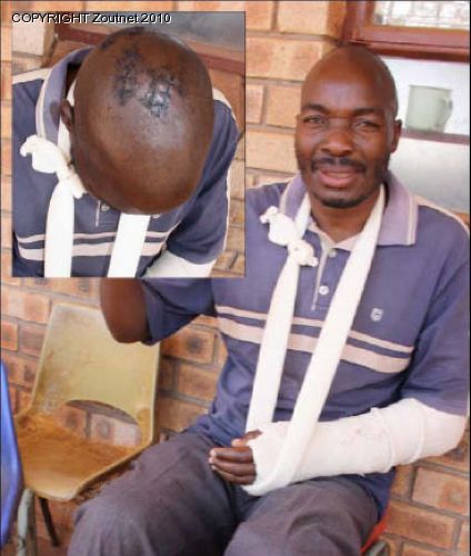 Village boils after civic leader is assaulted