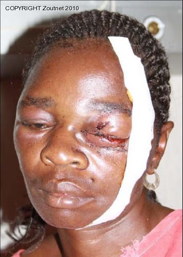 Woman seriously injured in mysterious attack