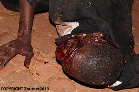 Beaten man found