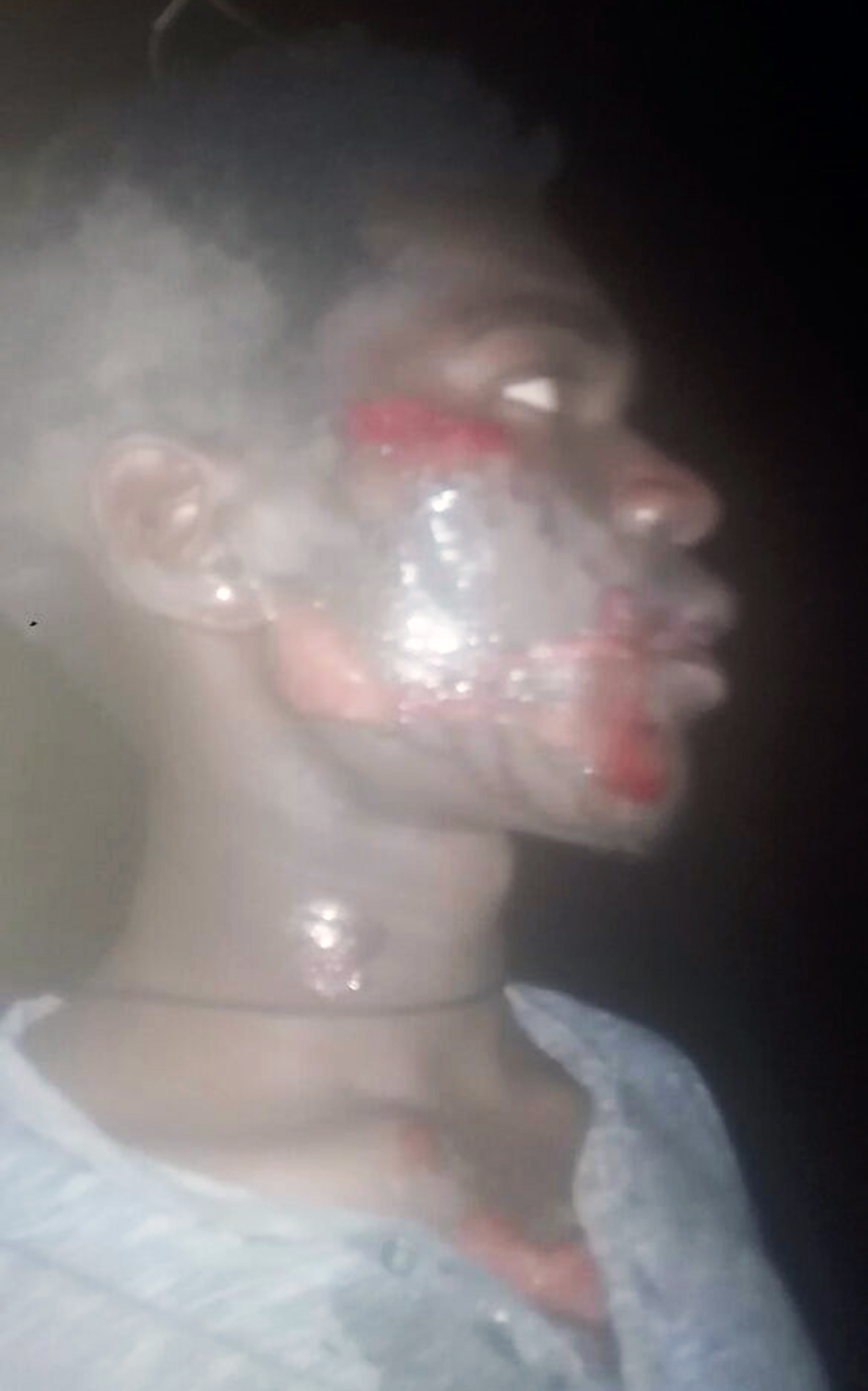 Pupil survives blades of murderers