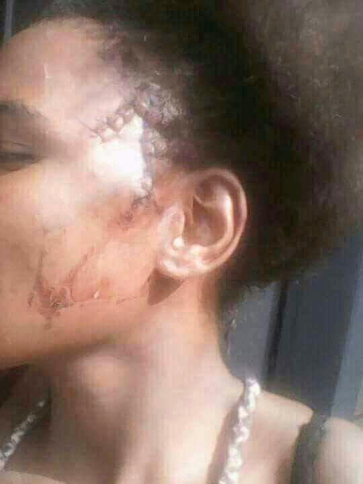 Catfight ladies continue fight in court