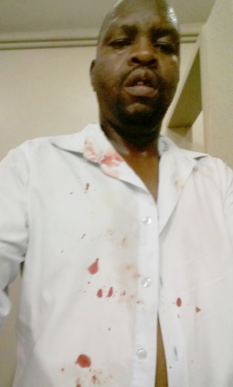 Match officials assaulted after Motsepe game