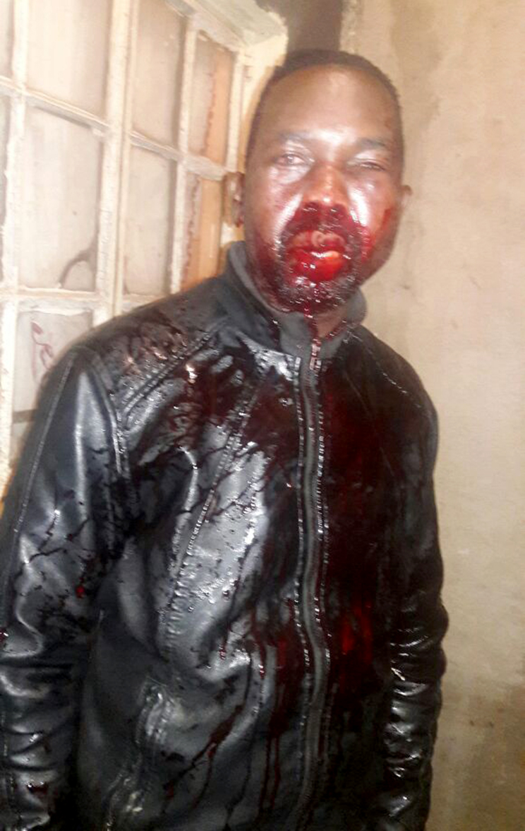 Suspect beaten up at Mpheni