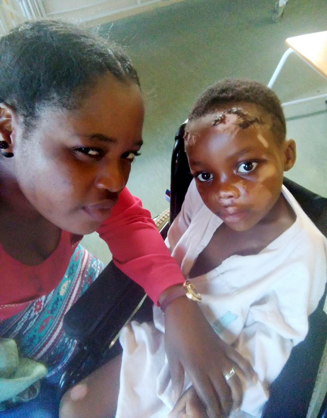 Loss of leg doesn't stop brave little five-year-old