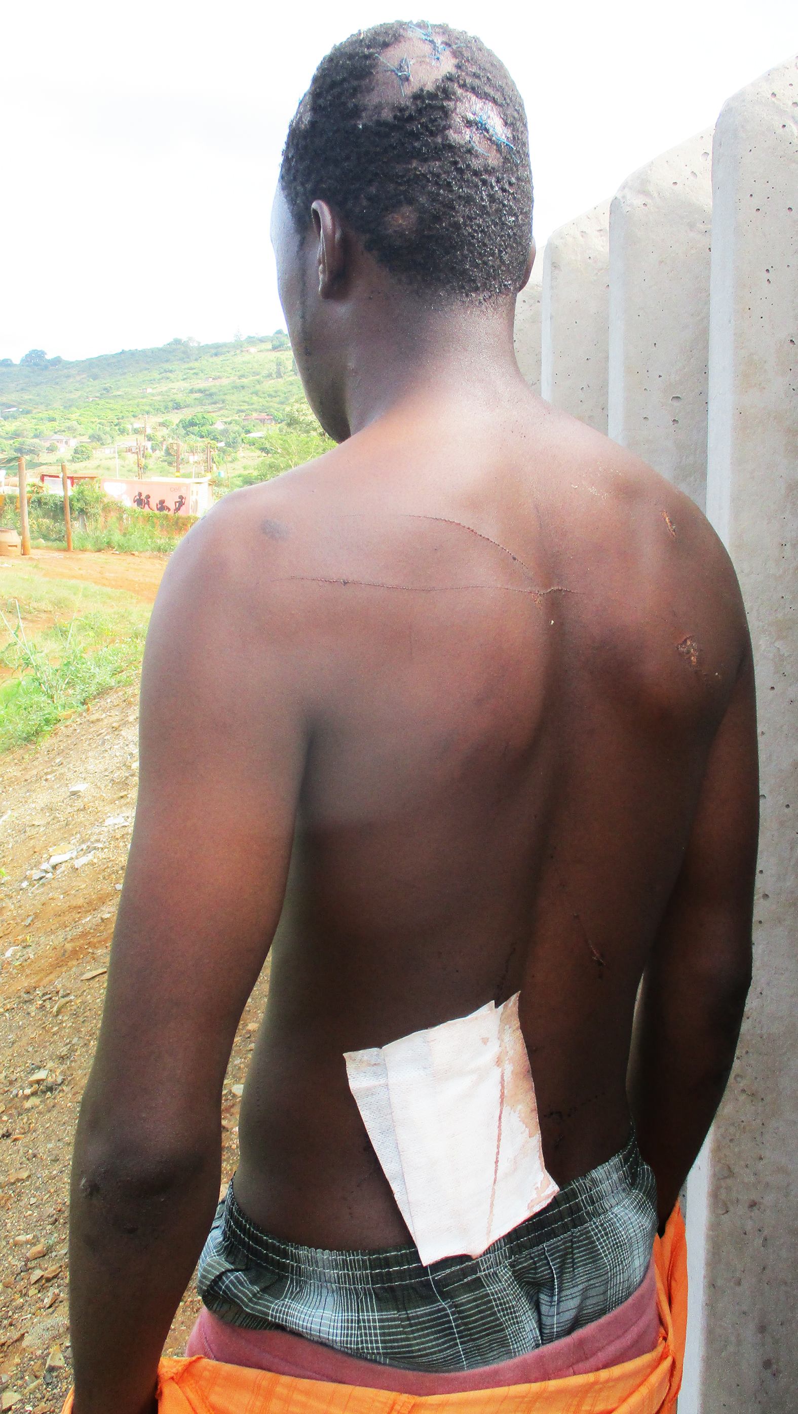 Xenophobic attacks or hooliganism?
