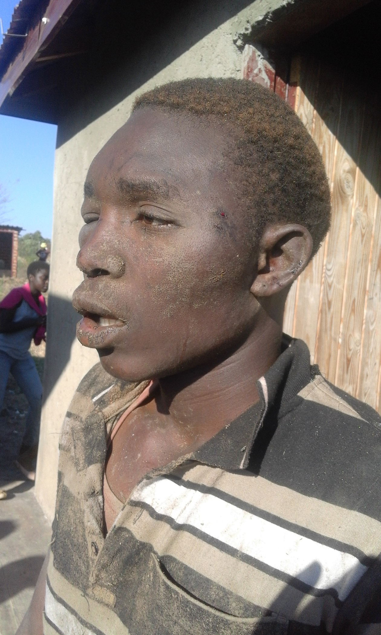 Alleged criminal feels the wrath of the community