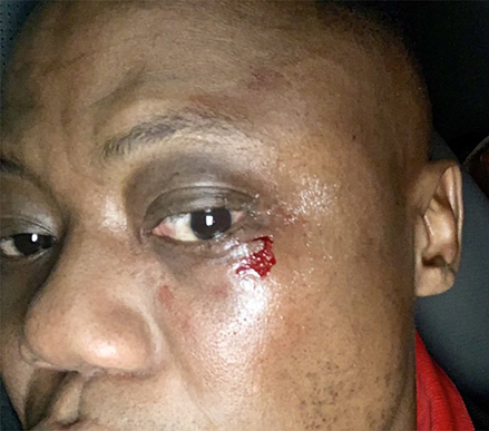 DJ Tira hit with a bottle while performing at Univen