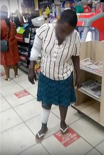 Woman claims being set on fire after stealing food worth R25