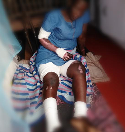 Spar workers fired who set woman alight