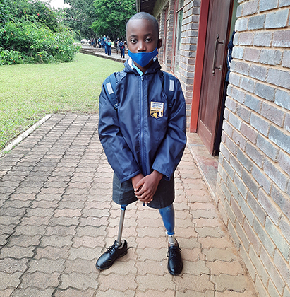 Promising future for young double amputee
