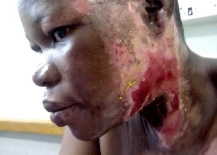 Legal system has failed us, says scarred woman