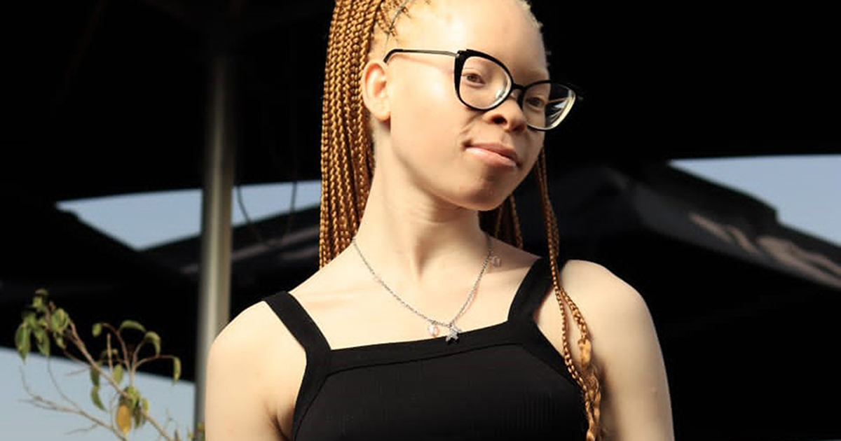 Ndou o vhea ito ḽawe kha uvha ra lunako wa Albinism.