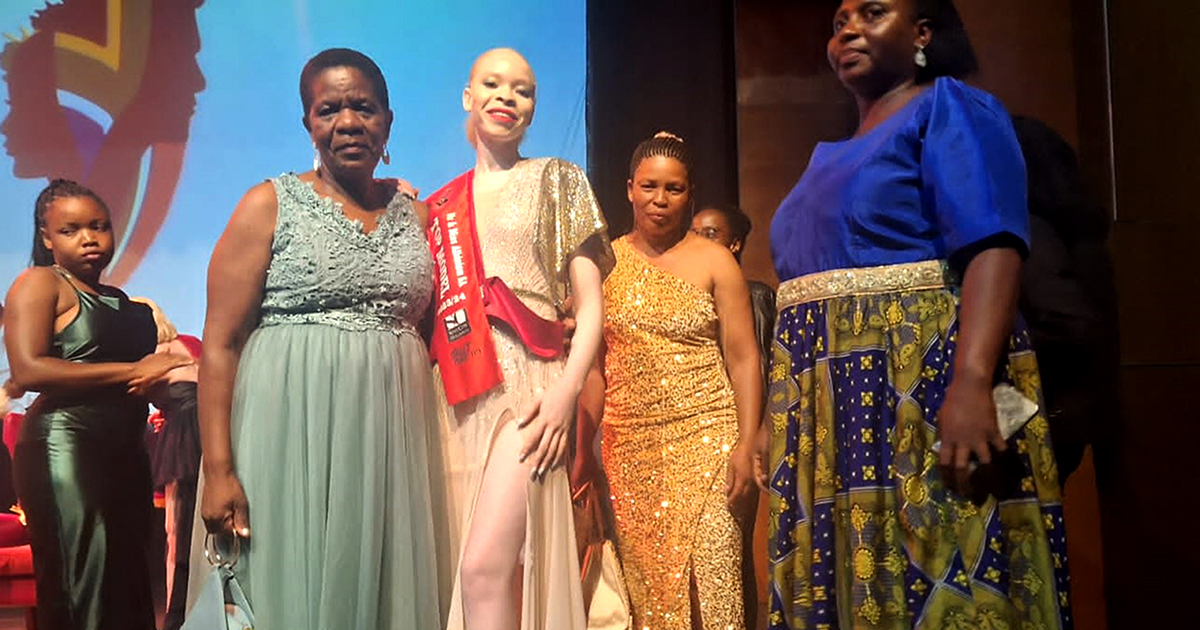 Engedzani o kunda uvha Mrs Albinism 2023/24