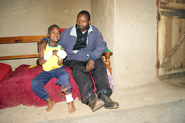 5-Year-old child sustains serious burns at school